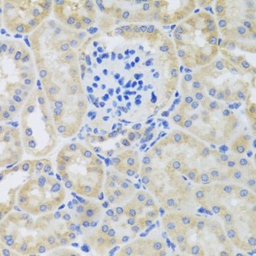 Anti-BNIP3 antibody produced in rabbit