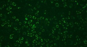 Monoclonal Anti-Dengue virus NS1 protein antibody produced in mouse clone GT4212, affinity isolated antibody