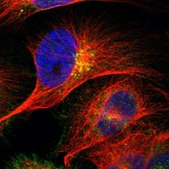 Anti-SDC4 antibody produced in rabbit Prestige Antibodies® Powered by Atlas Antibodies, affinity isolated antibody, buffered aqueous glycerol solution