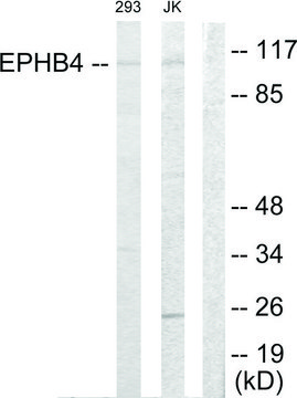 Anti-EPHB4 antibody produced in rabbit affinity isolated antibody