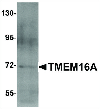 Anti-TMEM16A antibody produced in rabbit affinity isolated antibody, buffered aqueous solution