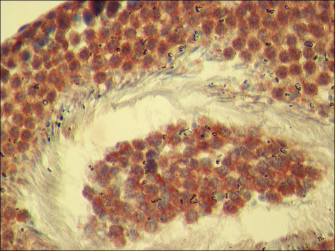 Anti-Rictor antibody produced in rabbit ~1-2&#160;&#956;g/mL, affinity isolated antibody