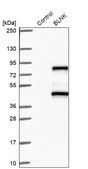 Anti-BLNK antibody produced in rabbit Prestige Antibodies&#174; Powered by Atlas Antibodies, affinity isolated antibody, buffered aqueous glycerol solution