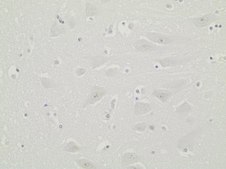 Anti-C9ORF72/C9RANT (poly-GR) Antibody, clone 5A2 clone 5A2, 1 mg/mL, from rat