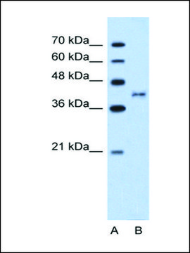 Anti-BDKRB2 antibody produced in rabbit IgG fraction of antiserum