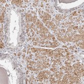 Anti-NUP153 antibody produced in rabbit Prestige Antibodies® Powered by Atlas Antibodies, affinity isolated antibody, buffered aqueous glycerol solution, ab1