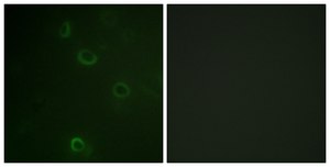 Anti-ATPASE antibody produced in rabbit affinity isolated antibody