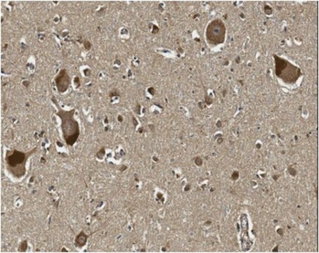 Anti-Oligodendrocyte transcription factor 2 (OLIG2 Antibody) serum, from guinea pig