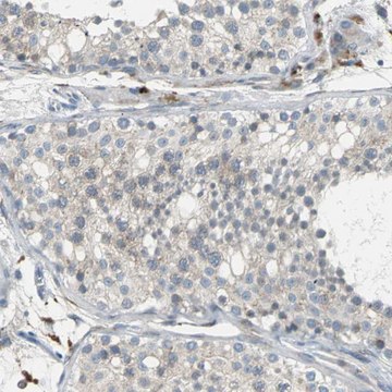 Anti-PTGDS antibody produced in rabbit Prestige Antibodies&#174; Powered by Atlas Antibodies, affinity isolated antibody, buffered aqueous glycerol solution