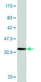 Monoclonal Anti-SDCCAG33 antibody produced in mouse clone 2F1, purified immunoglobulin, buffered aqueous solution
