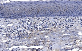 Anti-Collagen X α1 Antibody, clone 1O4 ZooMAb® Rabbit Monoclonal recombinant, expressed in HEK 293 cells