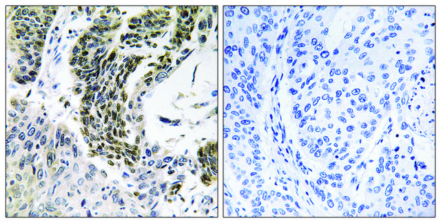 Anti-RREB1 antibody produced in rabbit affinity isolated antibody