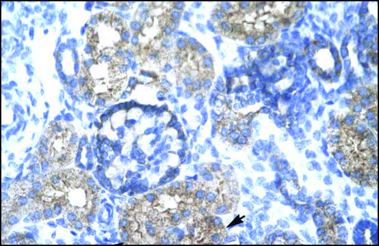 Anti-TRIM15 antibody produced in rabbit IgG fraction of antiserum