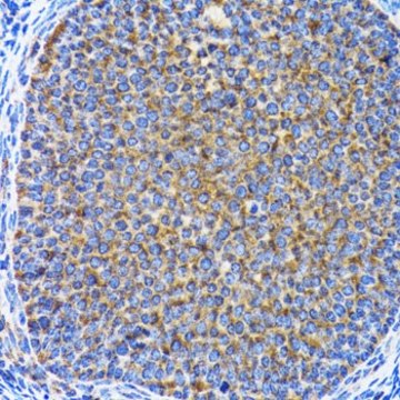 Anti-MAP1LC3A antibody produced in rabbit