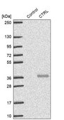 Anti-CTRL antibody produced in rabbit Prestige Antibodies® Powered by Atlas Antibodies, affinity isolated antibody, buffered aqueous glycerol solution