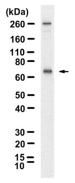 Anti-PKC &#950; Antibody, clone 1F20 ZooMAb&#174; Rabbit Monoclonal recombinant, expressed in HEK 293 cells