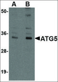 Anti-ATG5 antibody produced in chicken affinity isolated antibody, buffered aqueous solution