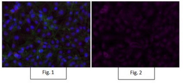 Anti-P40 Antibody, clone 11F12.1, Alexa Fluor&#8482; 647 clone 11F12.1, from mouse, ALEXA FLUOR&#8482; 647