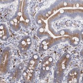 Anti-LCLAT1 antibody produced in rabbit Prestige Antibodies® Powered by Atlas Antibodies, affinity isolated antibody, buffered aqueous glycerol solution
