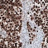 Monoclonal Anti-CHEK2 antibody produced in mouse Prestige Antibodies® Powered by Atlas Antibodies, clone CL9440, purified immunoglobulin, buffered aqueous glycerol solution