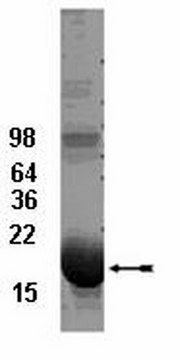 UbcH5b结合酶，100 &#181;g The His6-tagged fusion protein of UbcH5b is charge &amp; support ubiquitinylation in vitro. The His6-tagged UbcH5 family members all appear to form thiol ester conjugates with ubiquitin at a similar rate under similar conditions.