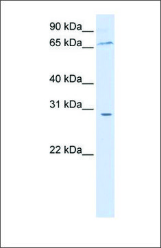 Anti-ZBTB48 (ab1) antibody produced in rabbit affinity isolated antibody