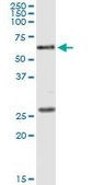 Monoclonal Anti-POLK antibody produced in mouse clone 4F12, purified immunoglobulin, buffered aqueous solution