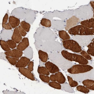 Anti-TNNI1 antibody produced in rabbit Prestige Antibodies&#174; Powered by Atlas Antibodies, affinity isolated antibody, buffered aqueous glycerol solution