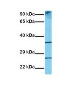 Anti-RAB14 antibody produced in rabbit affinity isolated antibody