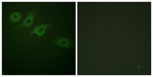 Anti-Interferon-γ Receptor α chain antibody produced in rabbit affinity isolated antibody