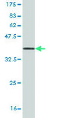Monoclonal Anti-UMPS antibody produced in mouse clone 2F5, purified immunoglobulin, buffered aqueous solution