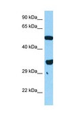 Anti-FOXL1 antibody produced in rabbit IgG fraction of antiserum