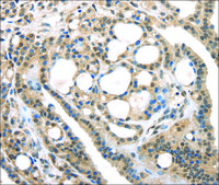 Anti-USP9X affinity isolated antibody