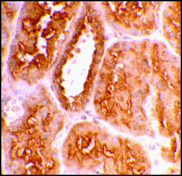 抗-ACE2 兔抗 affinity isolated antibody