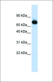 Anti-PATZ1 antibody produced in rabbit affinity isolated antibody