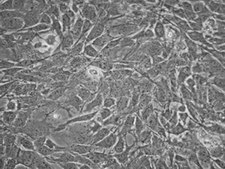 MS5-hDLL1 Stromal Cell Line The MS5-mDLL1 stromal cell line is used in a serum-free artificial thymic organoid (ATO) system to generate mature T-cells from human hematopoietic stem and progenitor cells.