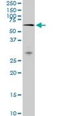 Monoclonal Anti-MAK, (C-terminal) antibody produced in mouse clone 3E5, purified immunoglobulin, buffered aqueous solution