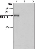 Anti-PIP5K3 (N-terminal) antibody produced in rabbit ~1.5 mg/mL, affinity isolated antibody, buffered aqueous solution