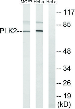 Anti-PLK2 antibody produced in rabbit affinity isolated antibody