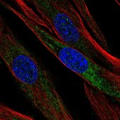 Anti-OGN antibody produced in rabbit Prestige Antibodies® Powered by Atlas Antibodies, affinity isolated antibody, buffered aqueous glycerol solution