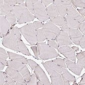 Anti-C17ORF51 antibody produced in rabbit Prestige Antibodies® Powered by Atlas Antibodies, affinity isolated antibody, buffered aqueous glycerol solution