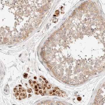 Anti-SARM1 antibody produced in rabbit Prestige Antibodies&#174; Powered by Atlas Antibodies, affinity isolated antibody, buffered aqueous glycerol solution, Ab2