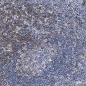 Anti-SKAP1 antibody produced in rabbit Prestige Antibodies® Powered by Atlas Antibodies, affinity isolated antibody, buffered aqueous glycerol solution