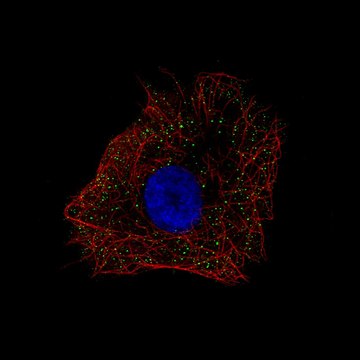 Anti-NDP antibody produced in rabbit Prestige Antibodies&#174; Powered by Atlas Antibodies, affinity isolated antibody, buffered aqueous glycerol solution