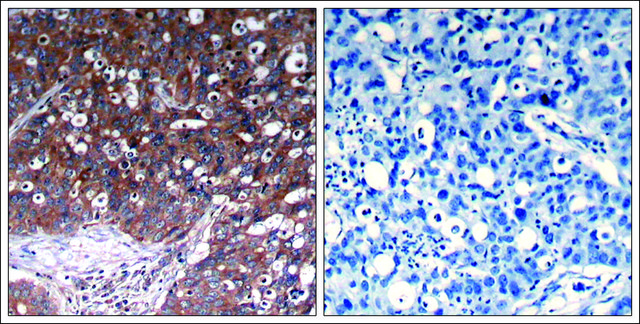 Anti-IGF1R (Ab-1280) antibody produced in rabbit affinity isolated antibody