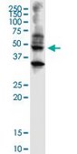 Monoclonal Anti-ABHD5 antibody produced in mouse clone 1F3, purified immunoglobulin, buffered aqueous solution