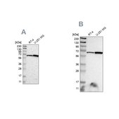 Anti-ME2 antibody produced in rabbit Prestige Antibodies® Powered by Atlas Antibodies, affinity isolated antibody, buffered aqueous glycerol solution