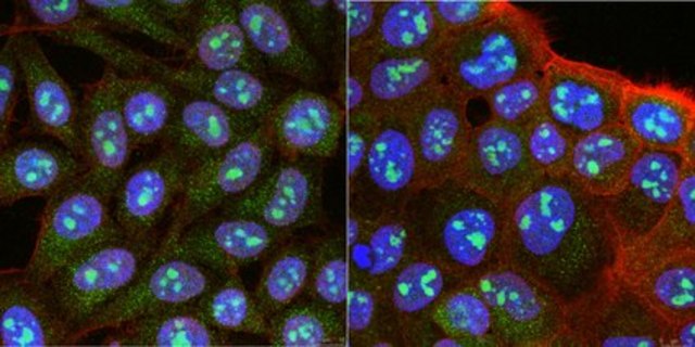 Anti-RRP8 Antibody, clone 5C7.1 clone 5C7.1, from mouse