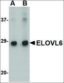 Anti-ELOVL6 antibody produced in rabbit affinity isolated antibody, buffered aqueous solution