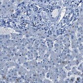 Anti-NACAD antibody produced in rabbit Prestige Antibodies® Powered by Atlas Antibodies, affinity isolated antibody, buffered aqueous glycerol solution